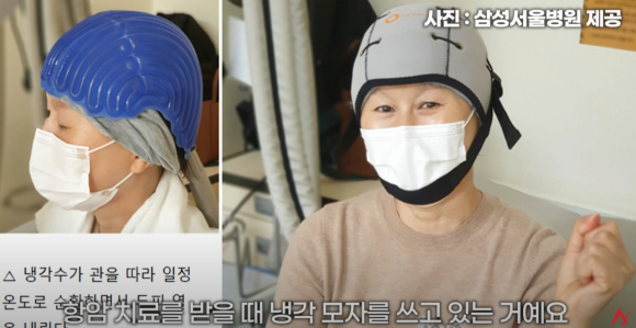 항암치료 탈모, 저용량 경구 미녹시딜 Q&A 관련 이미지 2