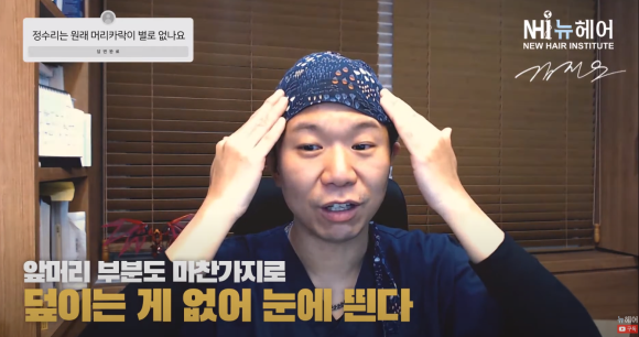 정수리에 머리카락이 없는 이유 l 탈모 관련 이미지 3