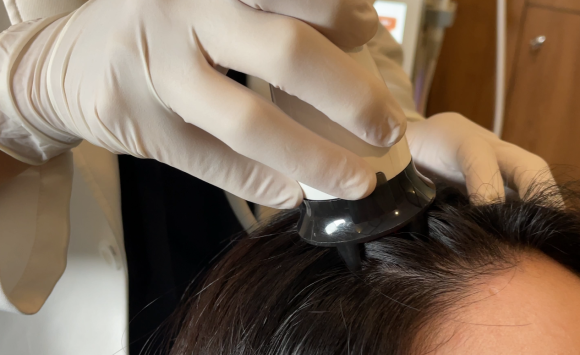 Will Hair Fall Out If You Have Anemia? image 8