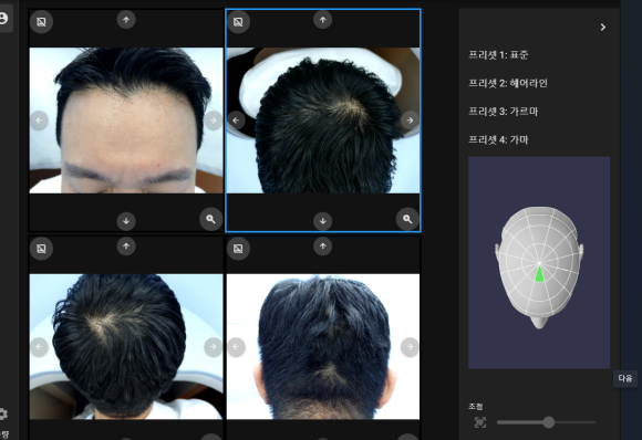 홍삼 캔디로 탈모치료 한다...? 관련 이미지 2