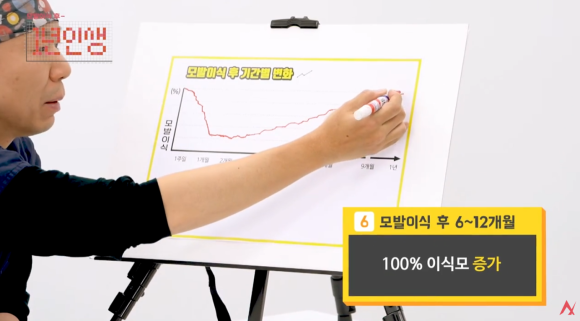 모발이식 암흑기 언제까지? 쉐딩과 차이, 이유 관련 이미지 8