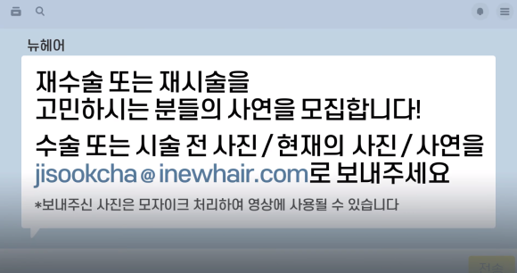 [뉴헤어] #모발이식 #헤어라인교정 #두피문신 #탈모치료 재수술/재시술 사연 모집 l 의사답변 관련 이미지 2