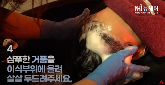 안무가 배윤정 씨, 출산 후 모발이식으로 찾는 자신감 관련 이미지 6