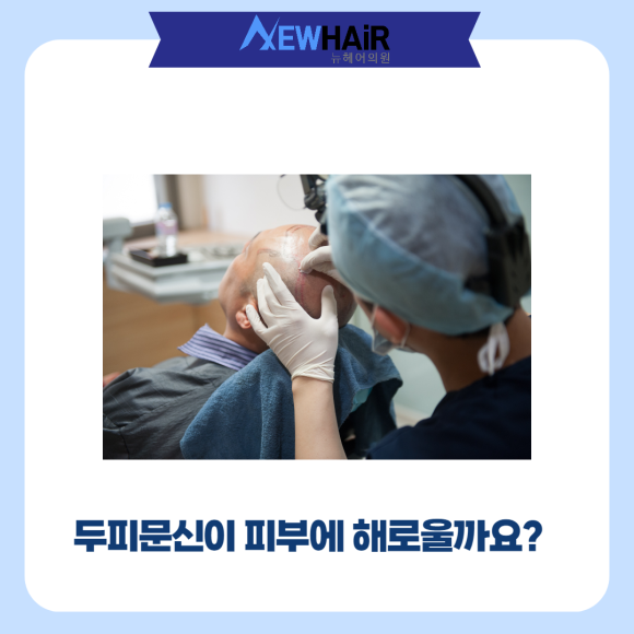 탈모두피문신 안전하고 믿을수 있는 곳에서 관련 이미지 2