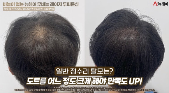 서울SMP, 2가지 있는지 확인해야 한다? 관련 이미지 3