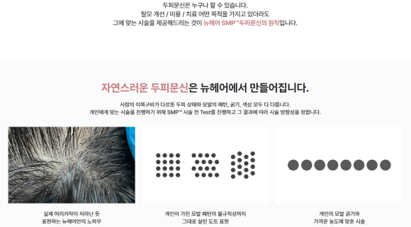 가르마 탈모 끝! 30대 여성 두피문신 전후 관련 이미지 10