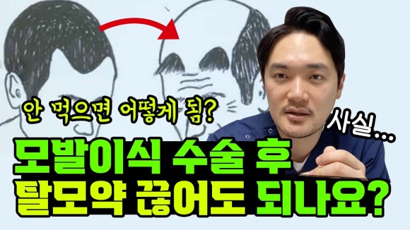 모발이식 후 약 먹어야 할까요? 관련 이미지 1