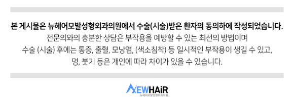 강남모발이식 m자교정 빈틈없이 빽빽하게 관련 이미지 14