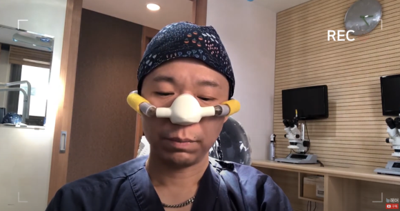 모발이식의 웃음 가스 마취법? 웃음 가스 후기 관련 이미지 2