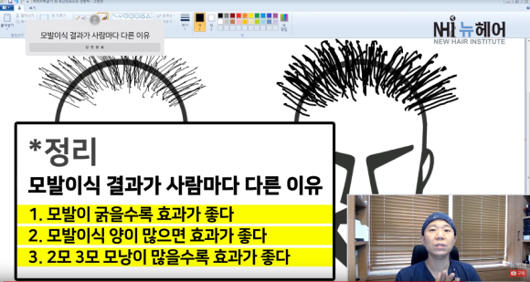 모발이식 결과가 사람마다 다른 이유  ㅣ모발이식 결과  l 모발이식 실패 관련 이미지 4