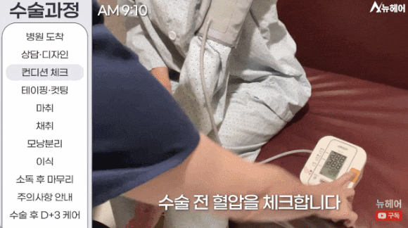모발이식과정? A~Z 전부 공개합니다(동영상 포함) 관련 이미지 3