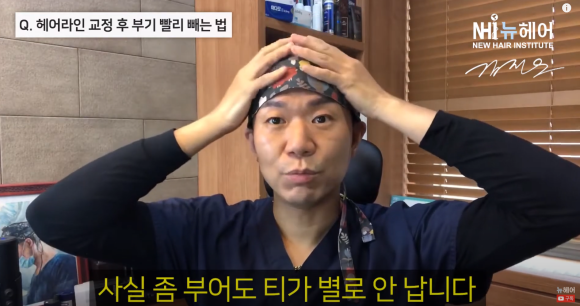 [뉴헤어] 모발이식 의사가 말하는 헤어라인 교정 후 부기 빨리 빼는 법 관련 이미지 3