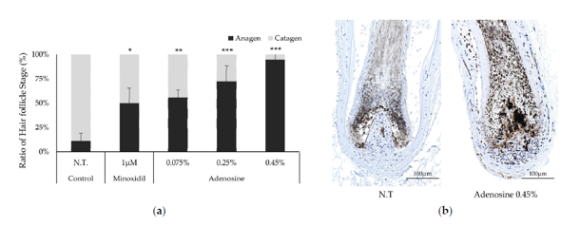 Hair Loss Treatment Using Adenosine image 2