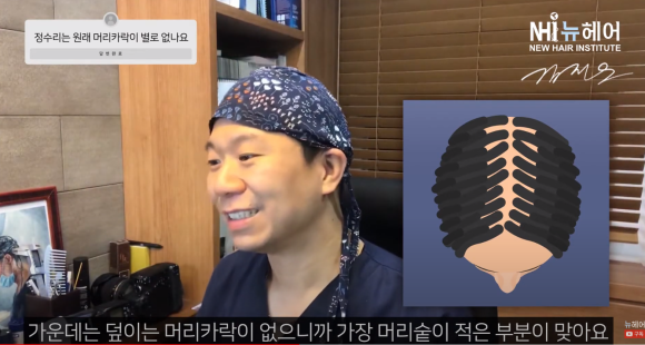 정수리에 머리카락이 없는 이유 l 탈모 관련 이미지 2