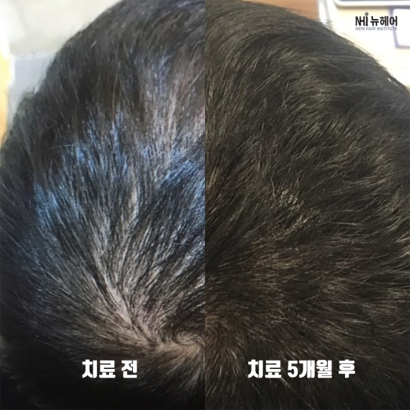 [뉴헤어] 관련 이미지 2
