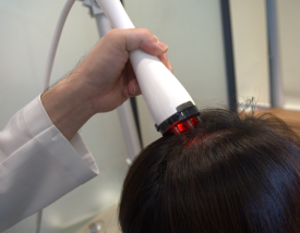 Female Hair Loss: What Symptoms Appear and How Should It Be Managed? image 5