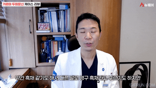 머리숱이 많아보이는 두피문신! 실제사례후기로 보는 비포&애프터 관련 이미지 3