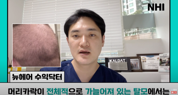 [뉴헤어] 모발이식으로도 해결 안 되는 탈모가 있다? l 탈모 주사의 효과는? 관련 이미지 18