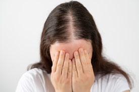 MZ세대 탈모 관리, 셀프 메디케이션? 가성비 치료방법? 관련 이미지 2