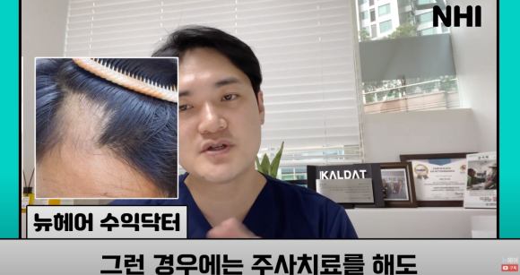 [뉴헤어] 모발이식으로도 해결 안 되는 탈모가 있다? l 탈모 주사의 효과는? 관련 이미지 22