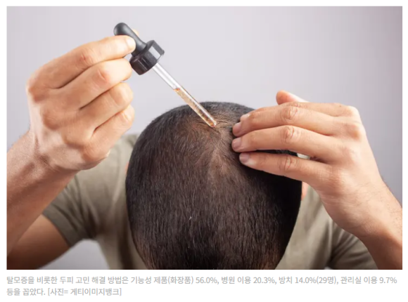 젊다고 방심하지 마세요! (2030 MZ 세대 65%는 탈모) 관련 이미지 2
