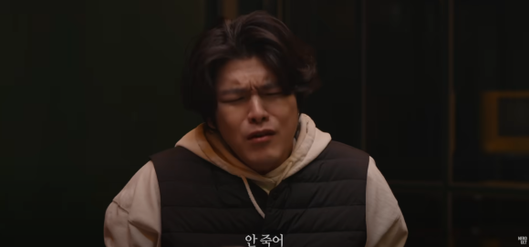 팔이 부러져도 병원 안 가던 그가, 탈모로 왔다 관련 이미지 3