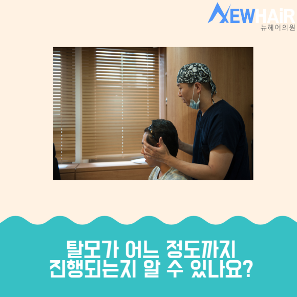 탈모검사 제대로 받고 치료하자 관련 이미지 6