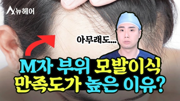 M자 모발이식 확인해야 할 것 관련 이미지 5