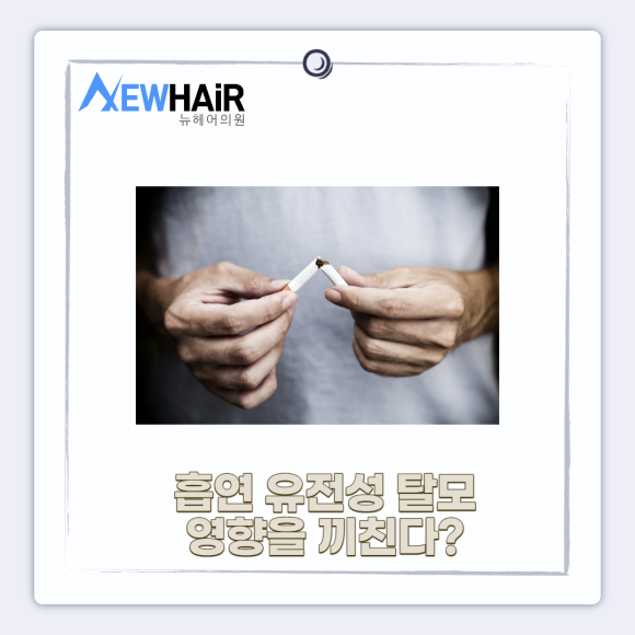 남성탈모 모발이식으로 해결 관련 이미지 3
