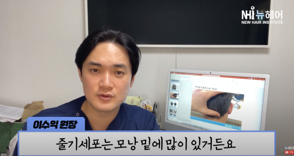 모발이식 실패? 이식모가 빠질 수 있나요? 관련 이미지 17