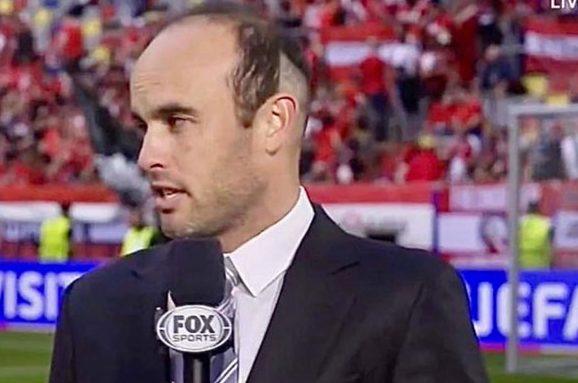 랜던 도노반의 사례로 본 모발이식 안전 영역과 채취 부위(비절개) 관련 이미지 3