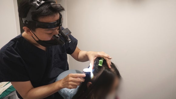 Autologous Cell Hair Loss Treatment, Treatment Using Autologous Follicle Cells image 1