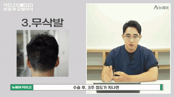비절개모발이식 종류와 선택 가이드 관련 이미지 7