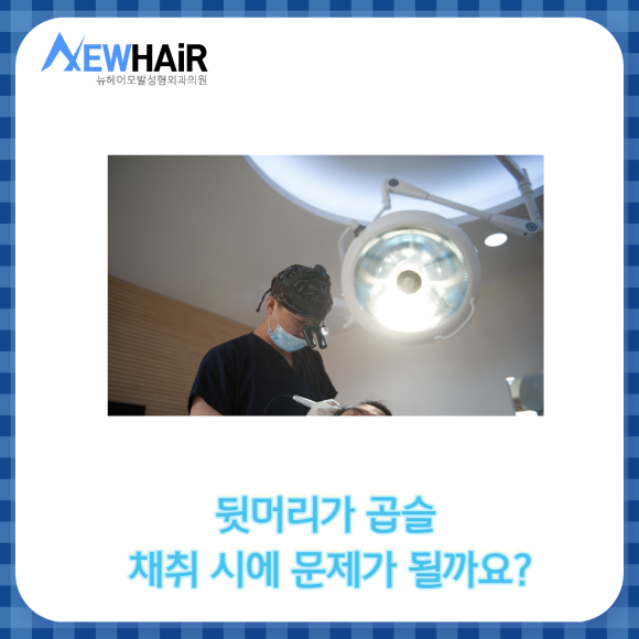 남자 앞머리탈모 정확한 치료방법은? 관련 이미지 6
