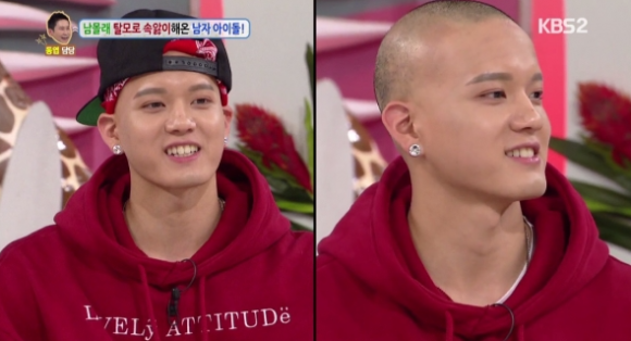연예인들이 선택하는 탈모치료법? 가발에서 모발이식까지 관련 이미지 2