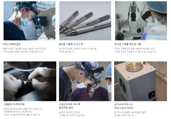 모발이식 통증, 얼마나 아픈가요? 관련 이미지 6