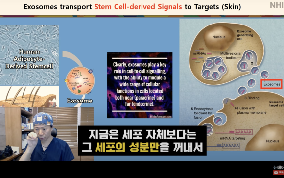 탈모치료 엑소좀, 엑소좀 뜻, 역할, 탈모 치료 효과ㅣ 정수리 탈모 ㅣ 전후사진 관련 이미지 8