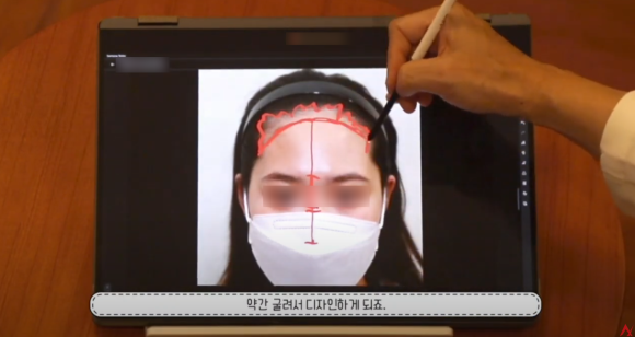 Hairline Design: What Criteria Should It Be Based On? image 4