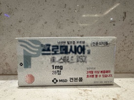 20대 M자 탈모, 약부터 먹어야 할까요? 원형탈모와 구별부터 모발이식 관련 이미지 4