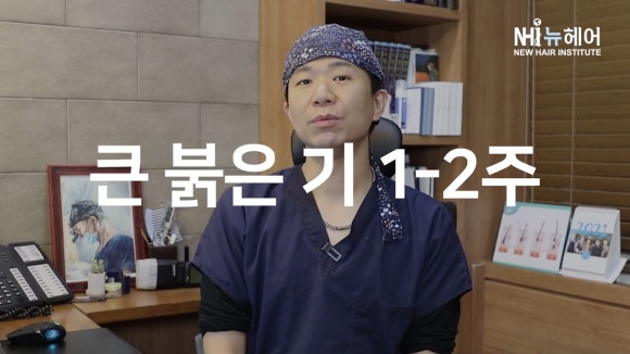 헤어라인교정(모발이식) 붉은 기... 언제 없어질까? 관련 이미지 3