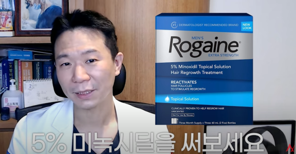 여성탈모는 남성용 미녹시딜을 써라?(효과,부작용) 관련 이미지 3