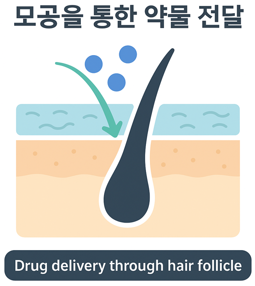탈모치료, 모공을 활용한 리포좀 기술은 어떤 가능성을 보여줄까? 관련 이미지 1