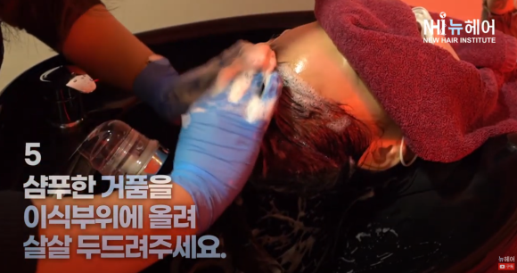 모발이식(헤어라인교정) 후 샴푸 방법 안내 관련 이미지 2