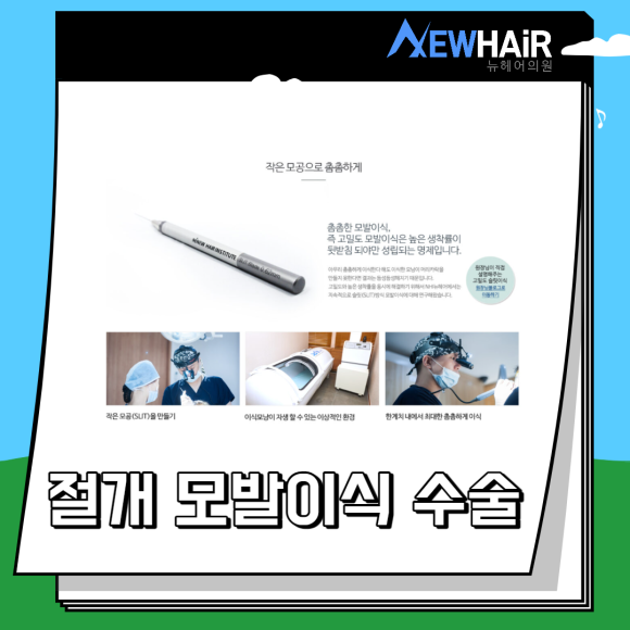 절개 모발이식 수술 총정리 관련 이미지 2