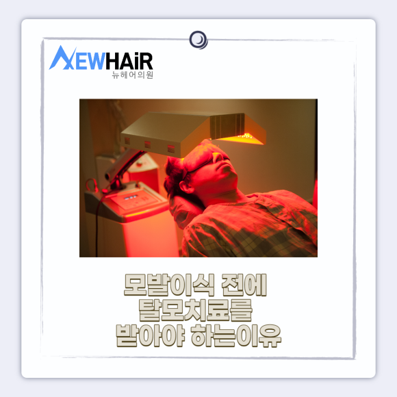 정수리탈모 관리 방법 알아보기 관련 이미지 5