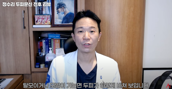 정수리탈모문신 시술직후 나타나는 효과?(전후사진) 관련 이미지 2