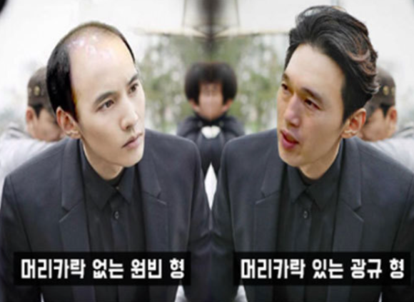 탈모병원추천? 딱 2가지만 확인하세요 관련 이미지 1