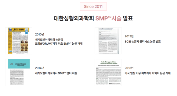 50대 여성 두피 문신(SMP)을 통한 정수리 탈모 치료 관련 이미지 4