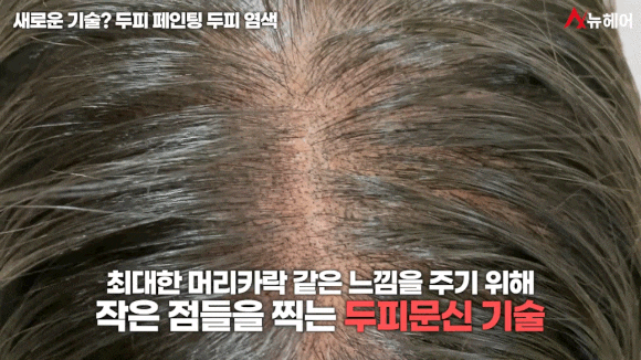 탈모커버 SMP두피문신, 두피페인팅(염색) 장단점 비교 관련 이미지 4