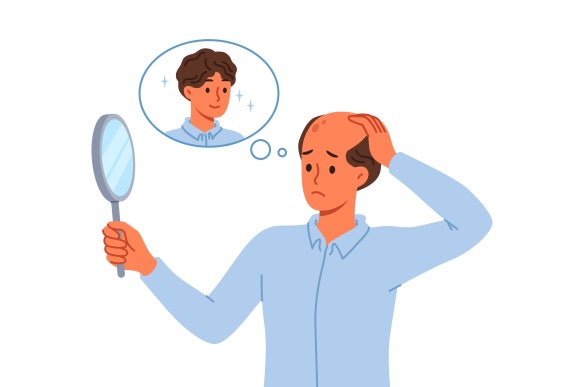고밀도 모발이식 무조건 풍성해지는 비결? 본질은? 관련 이미지 1
